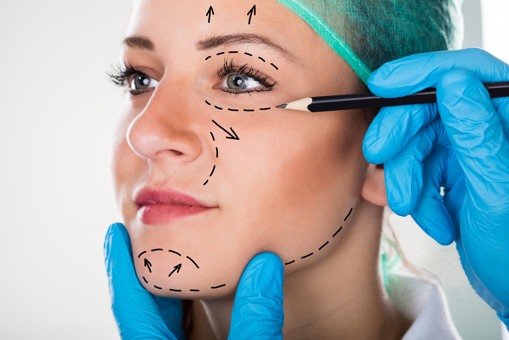 What Is A Mid-Face Lift & Effect Of Mid-Face Lift Surgery