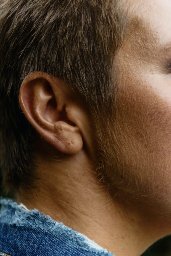 3 Possible Benefits From Getting Your Ears Pinned Back - Blog | Gary Ross