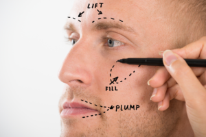 patient with drawings on face to prepare for surgery